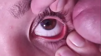 Cum eye